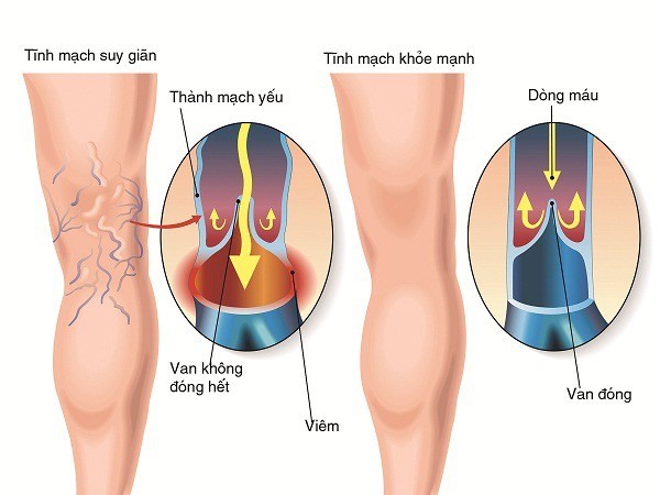 Lương y Phạm Ngọc Khánh giám đốc phòng chẩn trị YHCT Phước An Đường chữa bệnh bằng cả trái tim