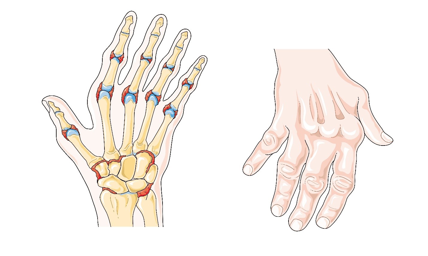 Học thuyết nguyên nhân gây bệnh và phương pháp điều trị bệnh từ gốc