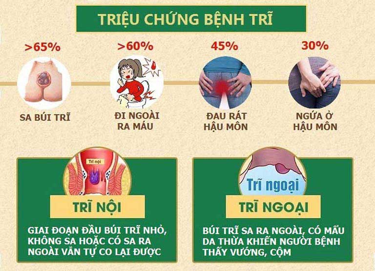 Bệnh trĩ và các bài thuốc Y học cổ truyền chữa trĩ hiệu quả, an toàn