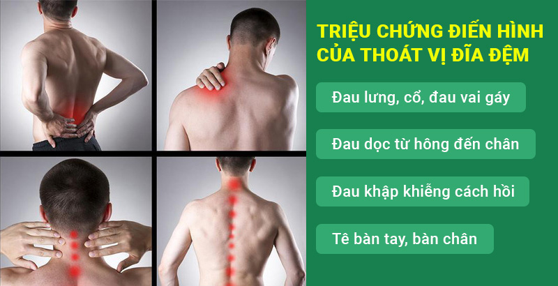 Thoát vị đĩa đệm và các bài thuốc y học cổ truyền chữa thoát vị đĩa đệm hiệu quả, an toàn