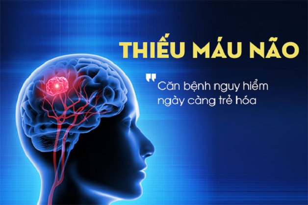 Những cây thuốc quý giúp tăng tuần hoàn máu não